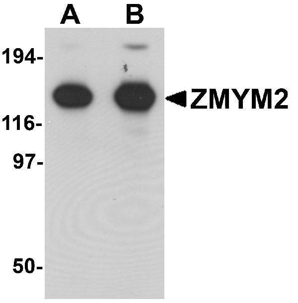 Western blot analysis of ZMYM2 in EL4 cell lysate with ZMYM2 antibody at (A) 0
