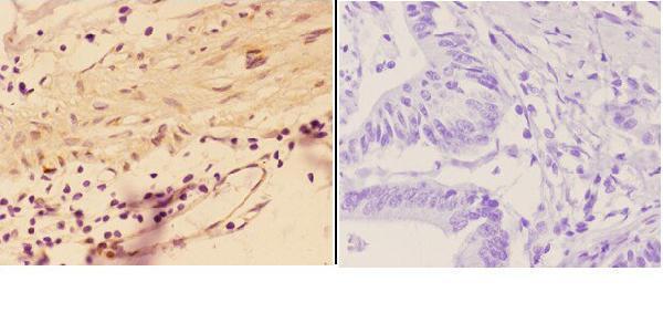 a04649 1 agrn primary antiboties ihc testing 2