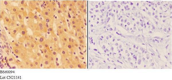 a04649 1 agrn primary antiboties ihc testing 3