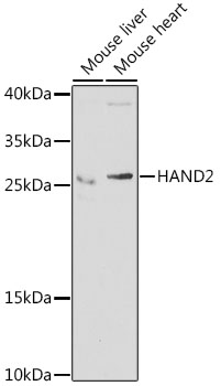 a04652 hand2 primary antiboties wb testing 1