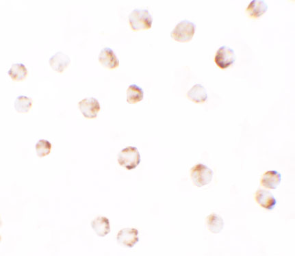 Immunocytochemistry of PIWI-L2 in HepG2 cells with PIWI-L2 antibody at 2
