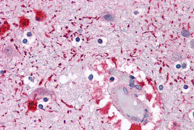 Immunohistochemistry of PIWI-L2 in human brain tissue with PIWI-L2 antibody at 5 μg/mL