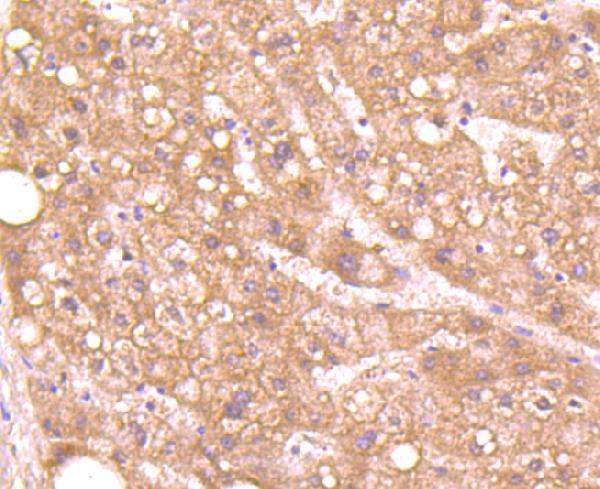Immunohistochemical analysis of paraffin-embedded human liver tissue using anti-Aggrecan antibody