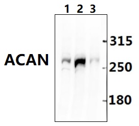Western blot (WB) analysis of ACAN polyclonal antibody at 1:500 dilution
Lane1:CT26 whole cell lysate
Lane2:C6 whole cell lysate
Lane3:Hela whole cell lysate