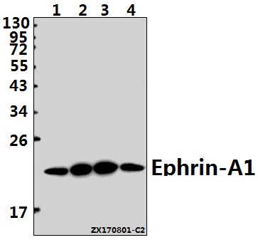 Western blot (WB) analysis of Ephrin-A1 (K98) pAb at 1:500 dilution
Lane1:U-87MG whole cell lysate(40ug)
Lane2:MCF-7 whole cell lysate(40ug)
Lane3:C6 whole cell lysate(40ug)
Lane4:CT26 whole cell lysate(40ug)