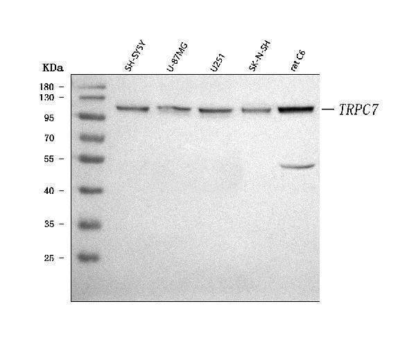 a04658 2 trpc7 primary antibodies wb testing 1