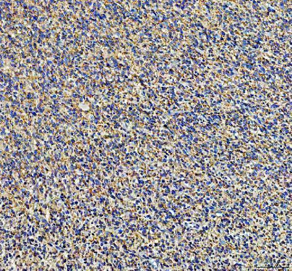 IHC analysis of EPHB3 using anti-EPHB3 antibody (A04659)