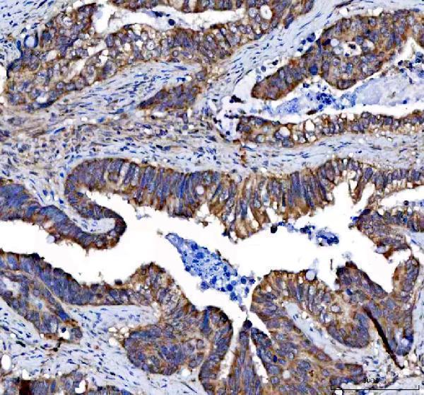 IHC analysis of EPHB3 using anti-EPHB3 antibody (A04659)