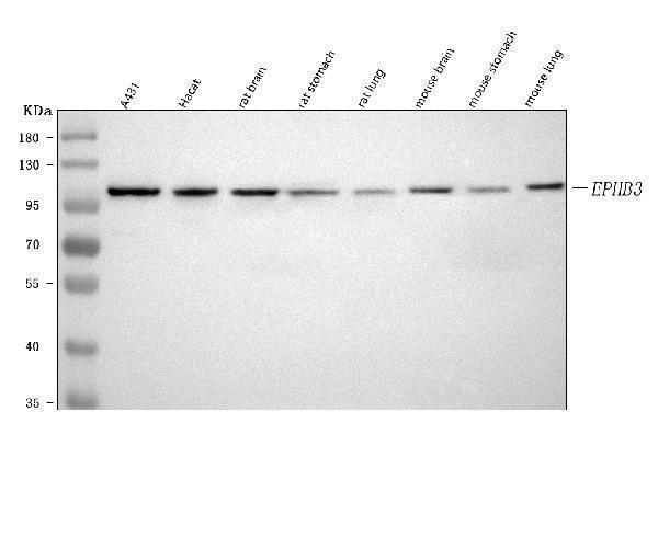  Western blot analysis of EPHB3 using anti-EPHB3 antibody (A04659)