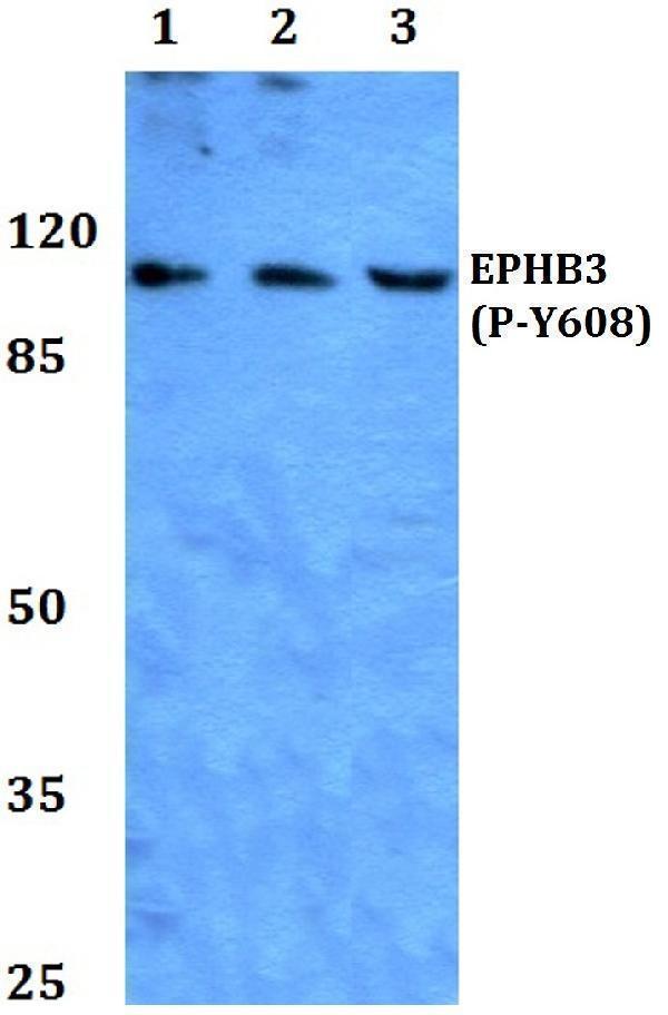 a04659y608 ephb3 primary antiboties wb testing 1