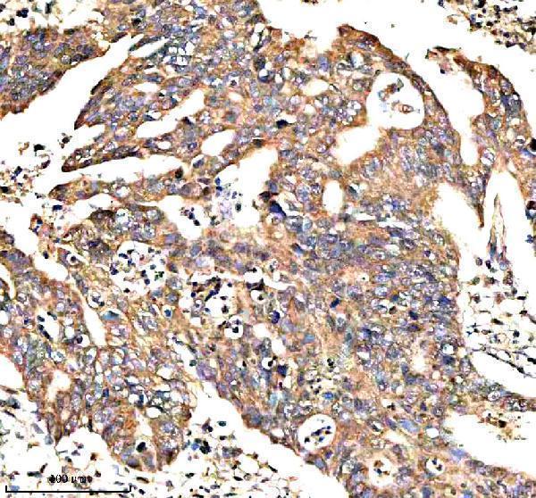 IHC analysis of NEK9 using anti-NEK9 antibody (A04660-1)