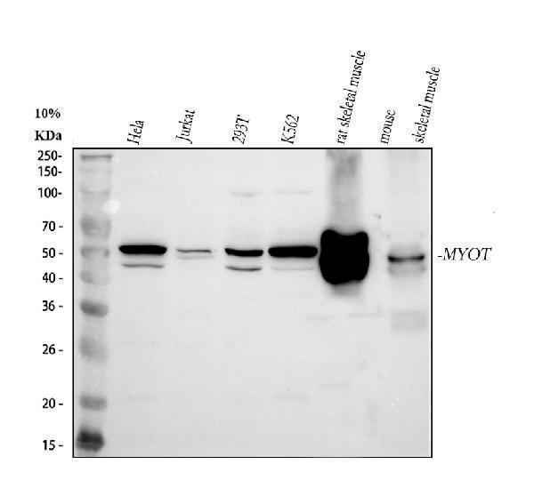  Western blot analysis of MYOT using anti-MYOT antibody (A04663-2)