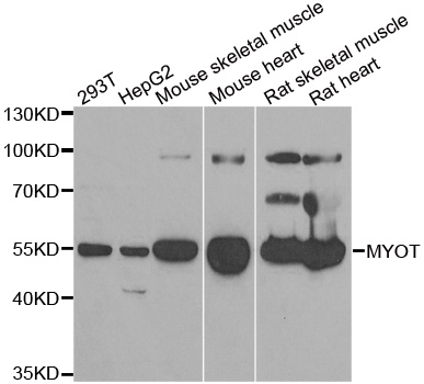 WesternBlot (WB) analysis of MYOT polyclonal antibody