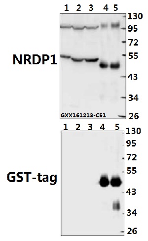 Western blot (WB) analysis of NRDP1 (E119) polyclonal antibody at 1:500 dilution
Lane1:H9C2 whole cell lysate(40ug)
Lane2:HCT116 whole cell lysate(40ug)
Lane3:A549 whole cell lysate(40ug)
Lane4:NRDP1 recombinant protein(100ng)
Lane5:NRDP1 recombinant protein(200ng)