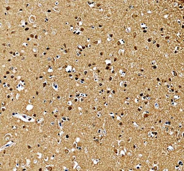 a04670 2 crppa primary antibodies ihc testing 1