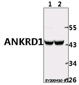 Western blot (WB) analysis of ANKRD1 pAb at 1:500 dilution
Lane1:The Muscle tissue lysate of Rat(40ug)
Lane2:The Muscle tissue lysate of Mouse(40ug)