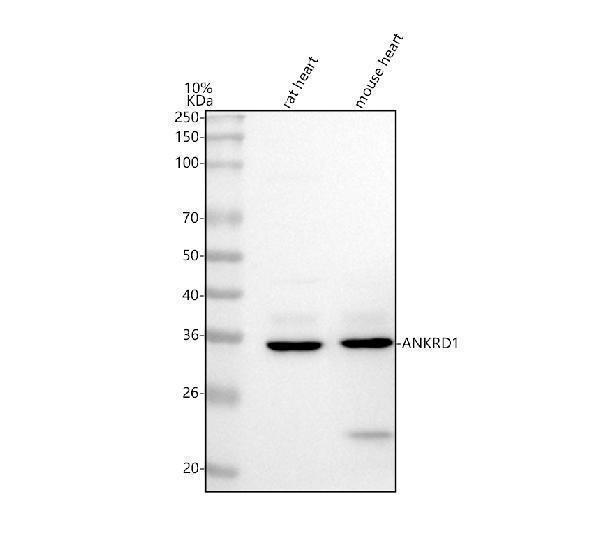 a04671 2 ankrd1 primary antibodies wb testing 1