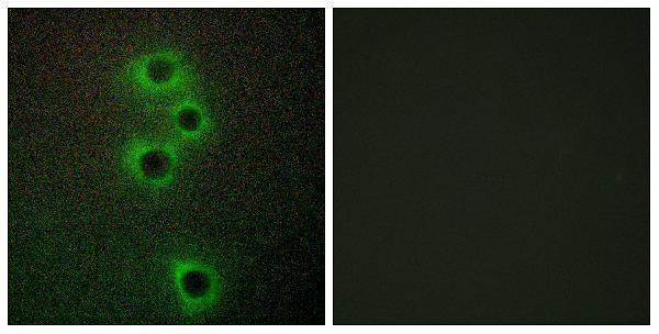 Immunofluorescence analysis of A549 cells, using MARK4 Antibody