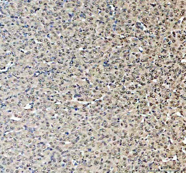 IHC analysis of HNRNPA3 using anti-HNRNPA3 antibody (A04676-1)