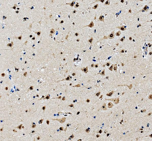 IHC analysis of HNRNPA3 using anti-HNRNPA3 antibody (A04676-1)
