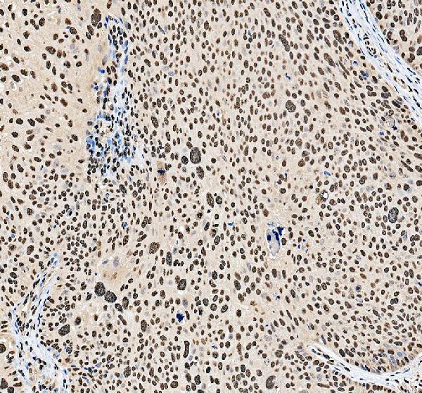 a04676 1 hnrnpa3 primary antibodies ihc testing 3