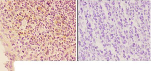 a04684 orm2 primary antiboties ihc testing 2