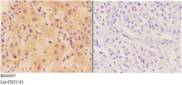 a04684 orm2 primary antiboties ihc testing 3