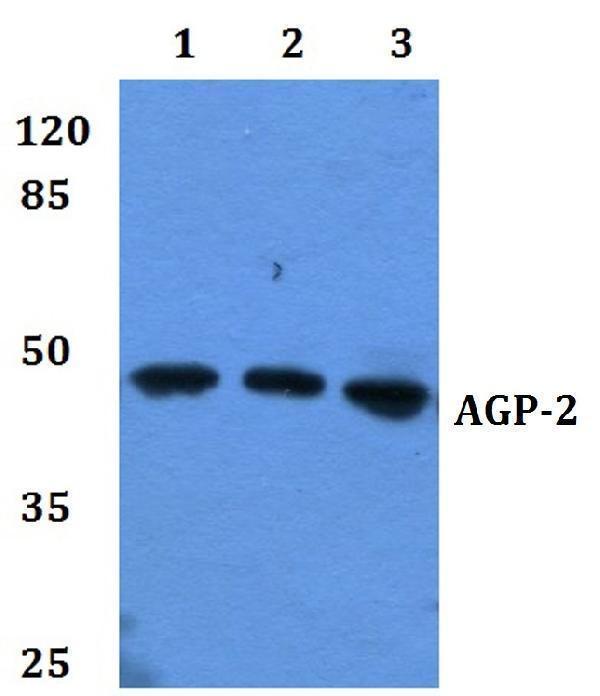 a04684 orm2 primary antiboties wb testing 1