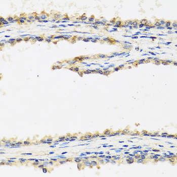 Immunohistochemistry of paraffin-embedded human prostate using SPINT1 antibody at dilution of 1:100 (40x lens)