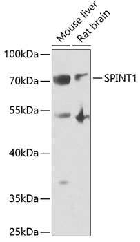 Western blot analysis of extracts of various cells, using SPINT1 antibody
