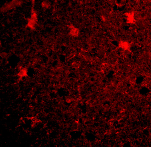 Immunofluorescence of BRCC36 in Human Brain cells with BRCC36 antibody at 20 μg/mL