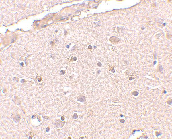 Immunohistochemistry of BRCC36 in human brain tissue with BRCC36 antibody at 2