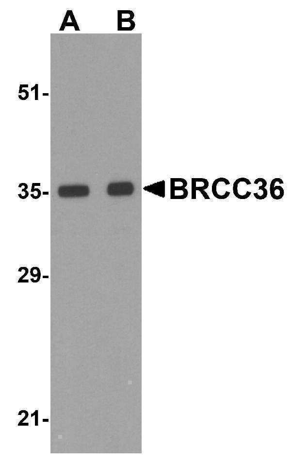 Western blot analysis of BRCC36 in MCF7 cell lysate with BRCC36 antibody at (A) 0