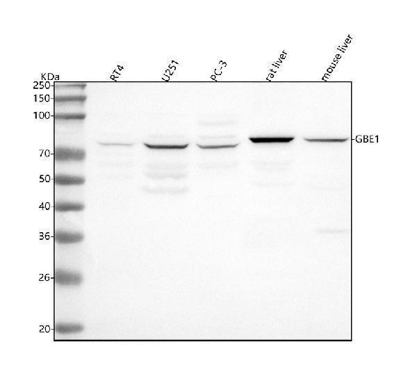  Western blot analysis of GBE1 using anti-GBE1 antibody (A04694-1)