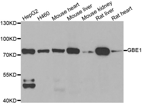 a04694 gbe1 primary antiboties wb testing 1