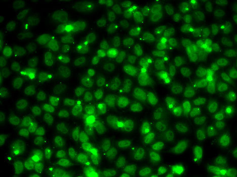 Immunofluorescence analysis of MCF7 cells using RPA3 antibody 