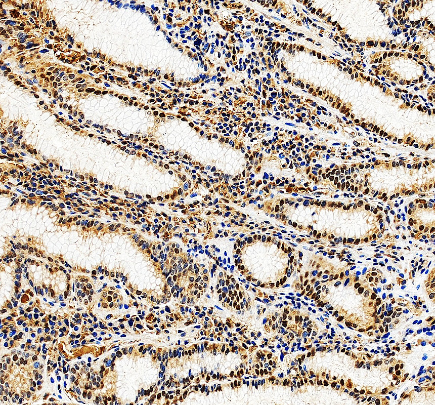 IHC analysis of RPA3 using anti-RPA3 antibody (A04696-2)