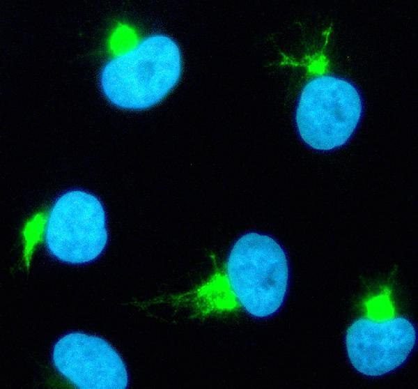 IF analysis of TBXAS1 using anti-TBXAS1 antibody (A04697-1)