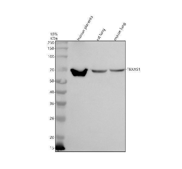 Western blot analysis of TBXAS1 using anti-TBXAS1 antibody (A04697-1)