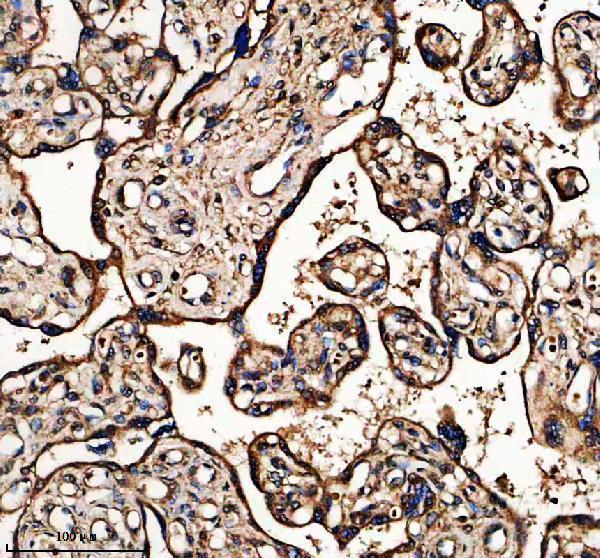 a04699 1 gpsm2 primary antibodies ihc testing 1