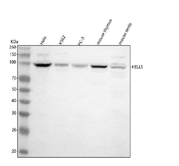  Western blot analysis of HELLS using anti-HELLS antibody (A04702-1)