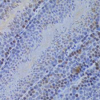 Immunohistochemistry of paraffin-embedded mouse testis using HELLS Antibody