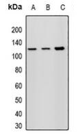 WesternBlot (WB) analysis of HELLS polyclonal antibody