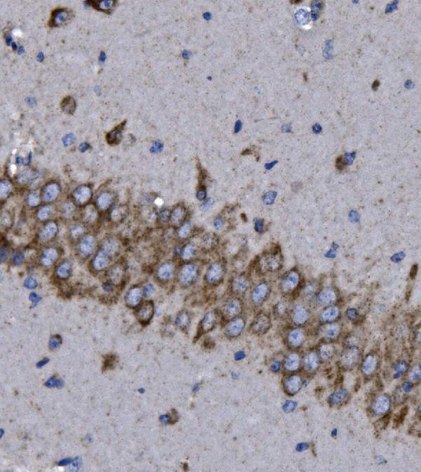a04705 1 kcnq5 primary antibodies ihc testing 2