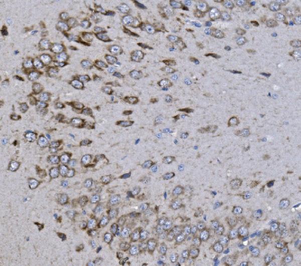 a04705 1 kcnq5 primary antibodies ihc testing 3