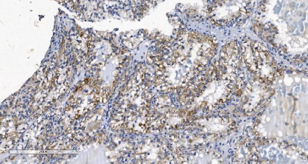 a04705 1 kcnq5 primary antibodies ihc testing 4