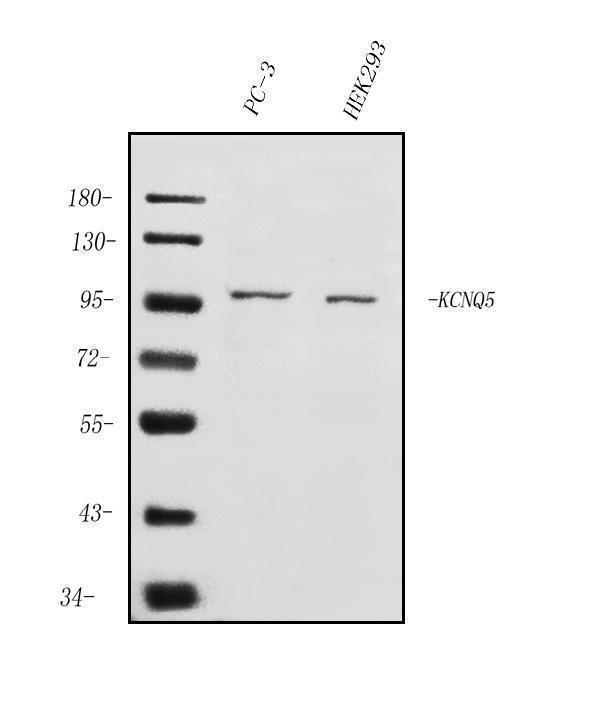 a04705 1 kcnq5 primary antibodies wb testing 1_1