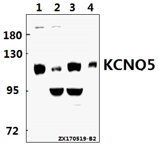 a04705 kcnq5 primary antiboties wb testing 1