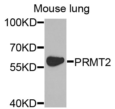 a04706 prmt2 primary antiboties wb testing 1