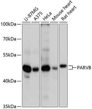 Western blot analysis of extracts of various cell lines, using PARVB antibody  at 1:3000 dilution